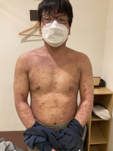 初回の写真 3ヶ月後の写真